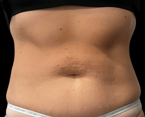 After Image: EON - front