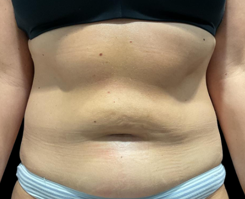 Before Image: EON - front