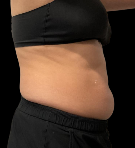 Before Image: EON - right-side