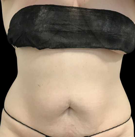 After Image: EON - front