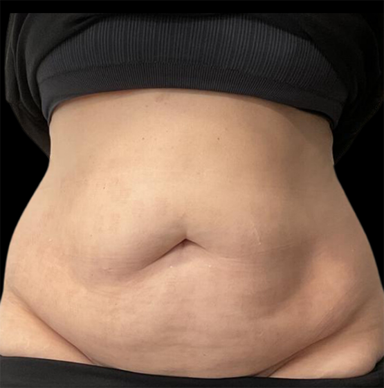 Before Image: EON - front