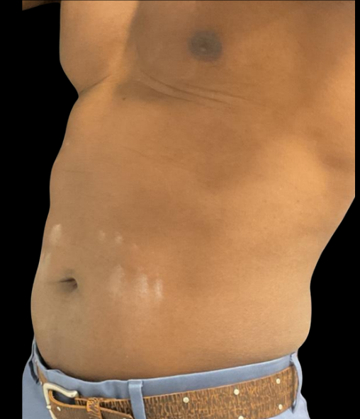 After Image: EON - left-front-oblique