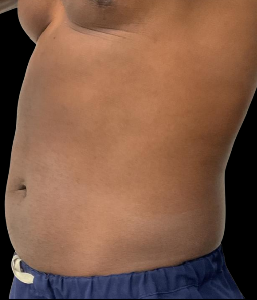 Before Image: EON - left-front-oblique