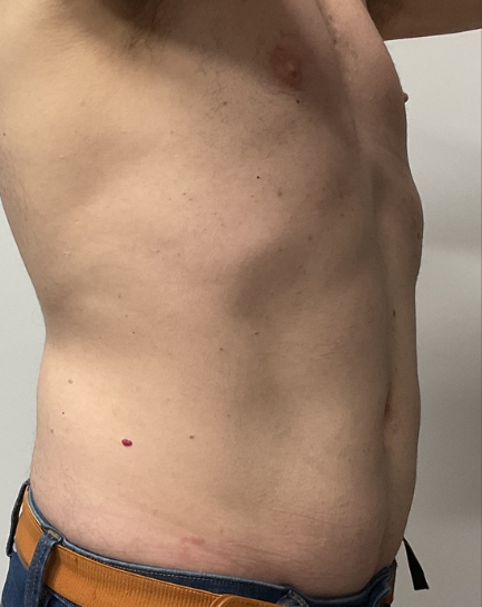 After Image: EON - right-front-oblique