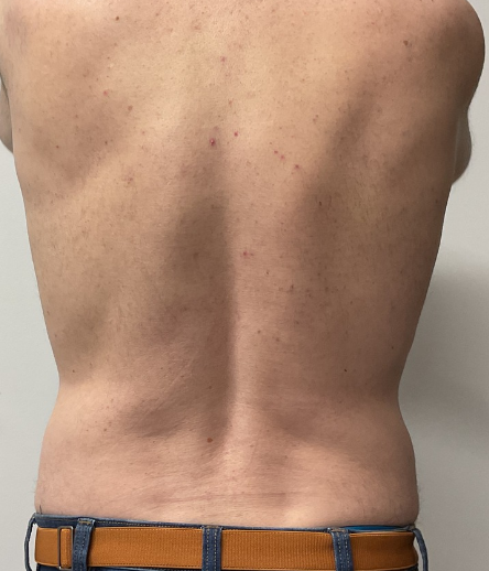After Image: EON - back
