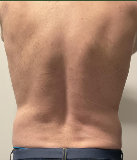 Before Image: EON - back