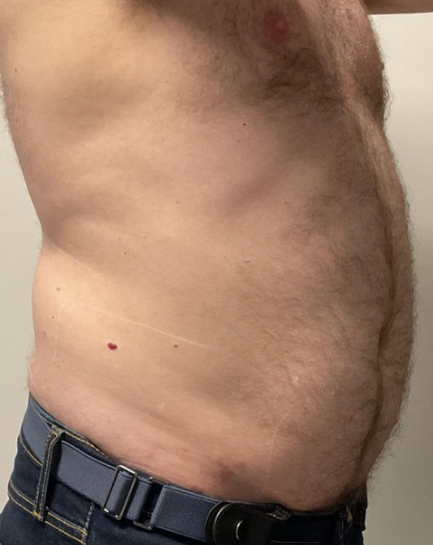 Before Image: EON - right-front-oblique