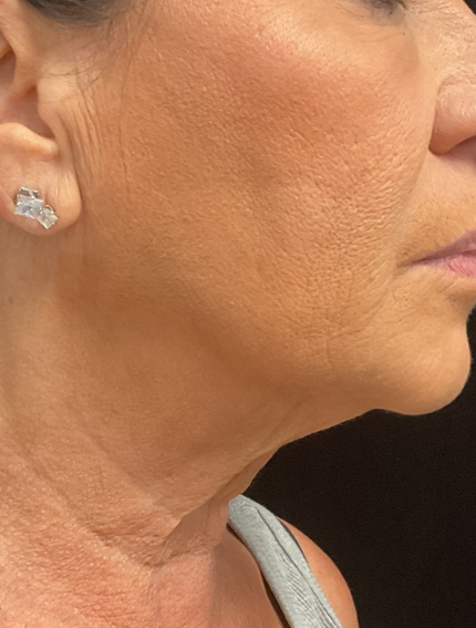 After Image: Tixel - right-side