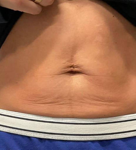 After Image: Tixel - front