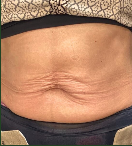 Before Image: Tixel - front